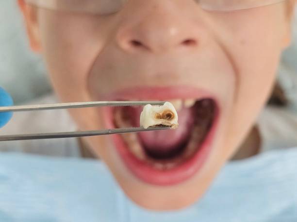 Best Pediatric Emergency Dentist in Florence Graham, CA